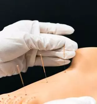 תור לרפואה אלטרנטיבית